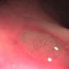 polyp Profile Image