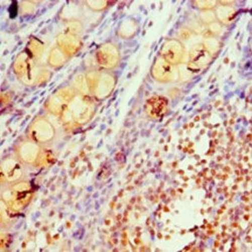 Portrait of Calcium Channel